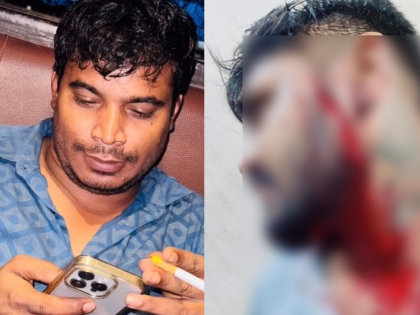 Thane Cafe Assault: 28-Year Old Hospitalized After Brutal Attack by History-Sheeter | Thane Cafe Assault: 28-Year Old Hospitalized After Brutal Attack by History-Sheeter