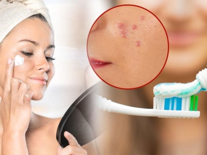 Simple solution for pimples, use toothpaste to get rid of acne | Simple solution for pimples, use toothpaste to get rid of acne