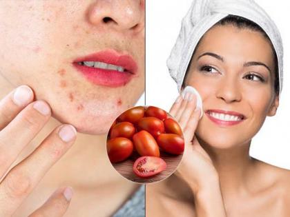 Beauty Tips: Remove Pimples and Dullness Naturally With Tomato and Multani Mitti Ahead of Ganesh Festival | Beauty Tips: Remove Pimples and Dullness Naturally With Tomato and Multani Mitti Ahead of Ganesh Festival Beauty Tips: Remove Pimples and Dullness Naturally With Tomato and Multani Mitti Ahead of Ganesh Festival | Beauty Tips: Remove Pimples and Dullness Naturally With Tomato and Multani Mitti Ahead of Ganesh Festival