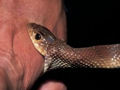 Uttar Pradesh Shock: 15-Year-Old Girl Survives Six Snakebites in One Month, Village in Panic | Uttar Pradesh Shock: 15-Year-Old Girl Survives Six Snakebites in One Month, Village in Panic Uttar Pradesh Shock: 15-Year-Old Girl Survives Six Snakebites in One Month, Village in Panic | Uttar Pradesh Shock: 15-Year-Old Girl Survives Six Snakebites in One Month, Village in Panic