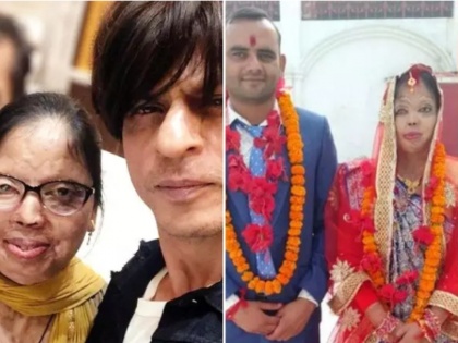 Shah Rukh Khan wishes love and happiness to acid attack survivor | Shah Rukh Khan wishes love and happiness to acid attack survivor