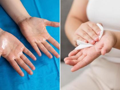 Summer Health Issues: Why Do Hands and Feet Sweat Excessively? Causes and Symptoms | Summer Health Issues: Why Do Hands and Feet Sweat Excessively? Causes and Symptoms Summer Health Issues: Why Do Hands and Feet Sweat Excessively? Causes and Symptoms | Summer Health Issues: Why Do Hands and Feet Sweat Excessively? Causes and Symptoms