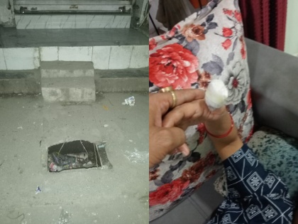 Thane Woman Suffers Severe Injuries After Falling In Open Gutter, Blames Civic Body For Negligence | Thane Woman Suffers Severe Injuries After Falling In Open Gutter, Blames Civic Body For Negligence
