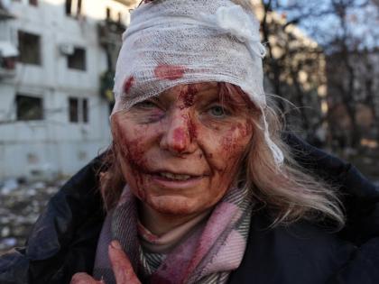 Ukraine Russia Conflict: 7,172 civilian casualties reported in Ukraine since war | Ukraine Russia Conflict: 7,172 civilian casualties reported in Ukraine since war