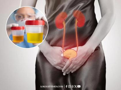Urine Color, Smell and Frequency: What Your Pee Reveals About Your Health | Urine Color, Smell and Frequency: What Your Pee Reveals About Your Health Urine Color, Smell and Frequency: What Your Pee Reveals About Your Health | Urine Color, Smell and Frequency: What Your Pee Reveals About Your Health