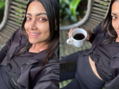 Actress Mamta Mohandas diagnosed with Vitiligo | Actress Mamta Mohandas diagnosed with Vitiligo
