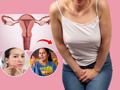 PCOS Diet: 3 Superfoods for Health & Balance