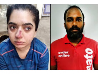 FIR filed against woman who accused Zomato delivery man of assaulting her | FIR filed against woman who accused Zomato delivery man of assaulting her