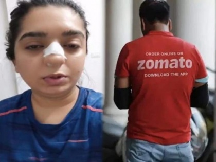 Zomato delivery boy assaults customer leaves her with broken nose | Zomato delivery boy assaults customer leaves her with broken nose
