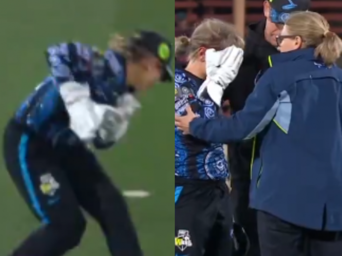 Bridget Patterson Suffers Nasty Injury After Ball Hits Her Face While