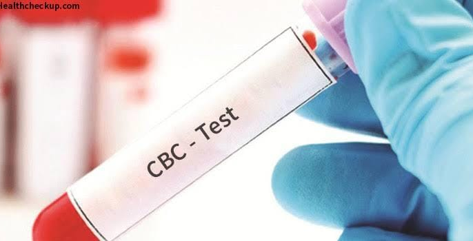 Complete Blood Count (CBC) Test: Purpose, Procedure, Normal Range, And ...