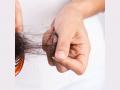Causes of Hair Loss, Homeopathic Remedies for Hair fall - Hindi News | Causes of Hair Loss, Homeopathic Remedies for Hair fall | Latest business News at Lokmattimes.com