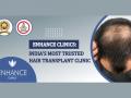 Enhance Clinics, India’s Most Trusted Hair Transplant Clinic - Hindi News | Enhance Clinics, India’s Most Trusted Hair Transplant Clinic | Latest business News at Lokmattimes.com