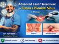 Advanced Laser Treatment for Fistula & Pilonidal Sinus in Thrissur – Dr. Raviram S - Hindi News | Advanced Laser Treatment for Fistula & Pilonidal Sinus in Thrissur – Dr. Raviram S | Latest business News at Lokmattimes.com