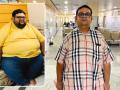 NOBESITY Surgery Helps Ahmedabad Resident Lose 109 Kg, Transforming Health and Life - Hindi News | NOBESITY Surgery Helps Ahmedabad Resident Lose 109 Kg, Transforming Health and Life | Latest business News at Lokmattimes.com