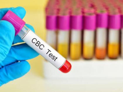 Reasons You Were Prescribed CBC Test | Reasons You Were Prescribed CBC Test Reasons You Were Prescribed CBC Test | Reasons You Were Prescribed CBC Test