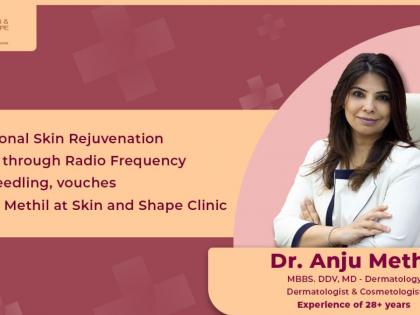 Exceptional Skin Rejuvenation Results through Radio Frequency Microneedling, vouches Dr. Anju Methil, Skin and Shape Clinic | Exceptional Skin Rejuvenation Results through Radio Frequency Microneedling, vouches Dr. Anju Methil, Skin and Shape Clinic Exceptional Skin Rejuvenation Results through Radio Frequency Microneedling, vouches Dr. Anju Methil, Skin and Shape Clinic | Exceptional Skin Rejuvenation Results through Radio Frequency Microneedling, vouches Dr. Anju Methil, Skin and Shape Clinic
