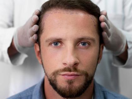 Breaking Down Types of Hair Transplant Techniques: FUT, FUE, DHI, & MHI Explained by Dr. Amit Agarkar | Breaking Down Types of Hair Transplant Techniques: FUT, FUE, DHI, & MHI Explained by Dr. Amit Agarkar Breaking Down Types of Hair Transplant Techniques: FUT, FUE, DHI, & MHI Explained by Dr. Amit Agarkar | Breaking Down Types of Hair Transplant Techniques: FUT, FUE, DHI, & MHI Explained by Dr. Amit Agarkar