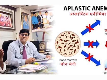 Homeopathy Gave Me a New Life: Lalaram Yadav’s Triumph Over Aplastic Anemia | Homeopathy Gave Me a New Life: Lalaram Yadav’s Triumph Over Aplastic Anemia Homeopathy Gave Me a New Life: Lalaram Yadav’s Triumph Over Aplastic Anemia | Homeopathy Gave Me a New Life: Lalaram Yadav’s Triumph Over Aplastic Anemia