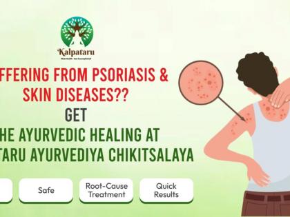 Psoriasis and Skin Diseases – The Ayurvedic Approach at Kalpataru Ayurvediya Chikitsalaya | Psoriasis and Skin Diseases – The Ayurvedic Approach at Kalpataru Ayurvediya Chikitsalaya Psoriasis and Skin Diseases – The Ayurvedic Approach at Kalpataru Ayurvediya Chikitsalaya | Psoriasis and Skin Diseases – The Ayurvedic Approach at Kalpataru Ayurvediya Chikitsalaya