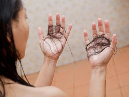 Hair gone, Regrown again – A homeopathic way to regain hair after Chemotherapy | Hair gone, Regrown again – A homeopathic way to regain hair after Chemotherapy Hair gone, Regrown again – A homeopathic way to regain hair after Chemotherapy | Hair gone, Regrown again – A homeopathic way to regain hair after Chemotherapy