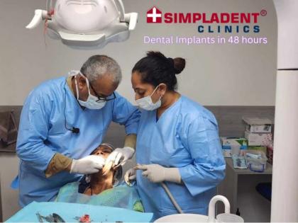 Transforming Smiles in 48 Hours: Simpladent Clinics Revolutionize Dental Implant Care Across India | Transforming Smiles in 48 Hours: Simpladent Clinics Revolutionize Dental Implant Care Across India Transforming Smiles in 48 Hours: Simpladent Clinics Revolutionize Dental Implant Care Across India | Transforming Smiles in 48 Hours: Simpladent Clinics Revolutionize Dental Implant Care Across India