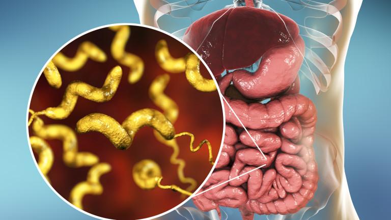 बड़ी आंत को सड़ाने वाली बीमारी IBS होने से पहले शरीर देता है 10 चेतावनी, तुरंत करें ये 4 काम