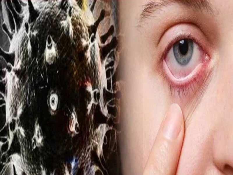 Black Fungus त ज स बढ रह ब ल क फ गस क म मल ह ल थ म न स ट र न बत य लक षण और बचन क 8 उप य