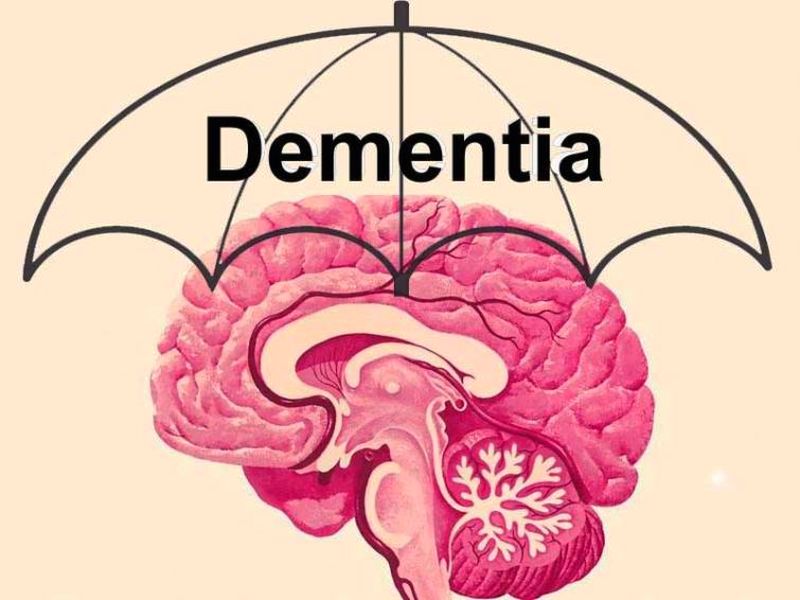 Dementia disease: रिसर्च में आया सामने चीज डिमेंशिया यानि मस्तिष्क रोग के खतरे को कम करता है