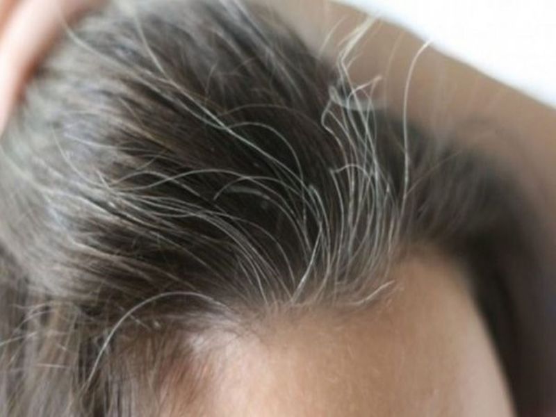 सफेद बालों का इलाज : सफेद बाल काले करने के घरेलू उपाय, घर ले आएं ये 6  चीजें, धीरे-धीरे काले होने लगेंगे सफेद बाल