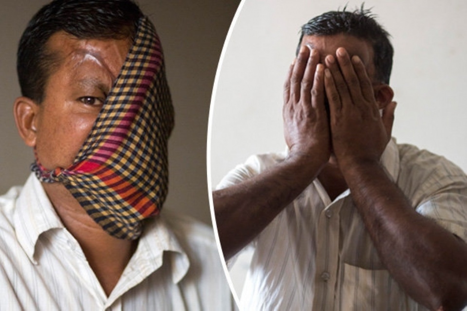 जब 20 साल के बाद इस शख्स ने अपने चेहरे से हटाया पर्दा, देखकर चकरा गया लोगों का सिर