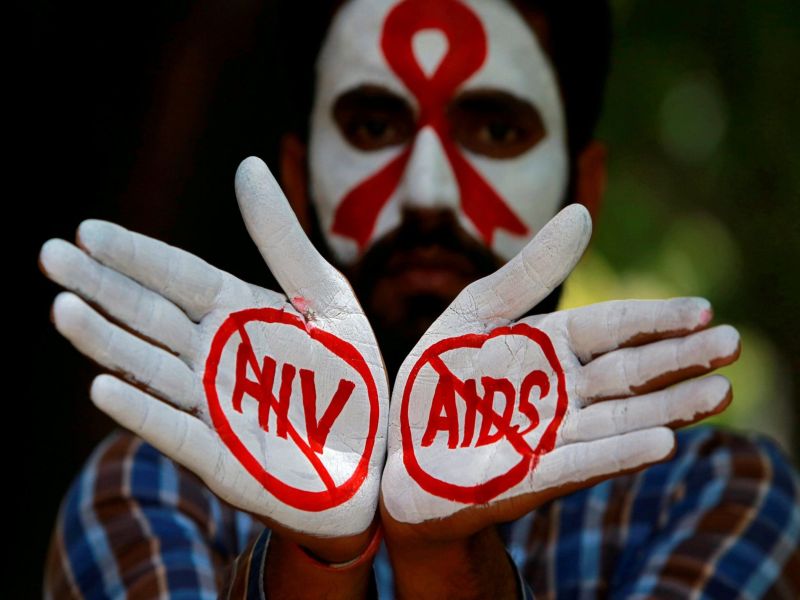 Hiv क नय द र लभ प रक र आय स मन ज न एचआईव क स क त और लक षण