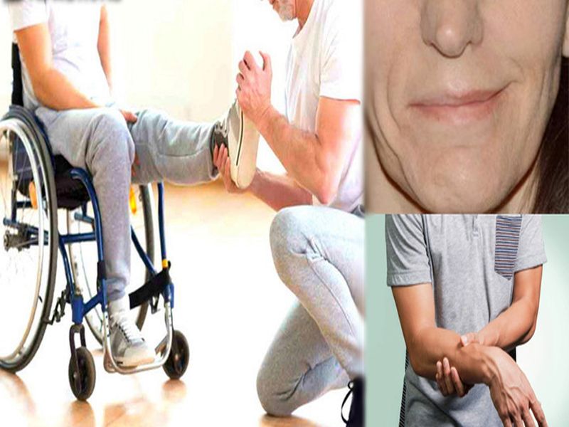 Treatment of Paralysis: Do these 6 things as soon as possible after a paralysis attack, the patient's condition will be cured.