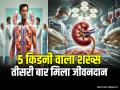 5 किडनी वाला शख्स, तीसरी बार मिला जीवनदान, पढ़ें पूरी खबर - Hindi News | A Man with 5 Kidneys Get Life for the Third time, 47 Year Old Man | Latest weird News at Lokmatnews.in