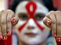 World AIDS Day 2023: दुनिया में लगभग आठ करोड़ लोग एचआईवी से संक्रमित, यौन रोग विशेषज्ञ डॉ दिनेश माथुर ने कहा- चार करोड़ से ज्यादा काल कवलित! - Hindi News | World AIDS Day 2023 eight crore people in world infected with HIV sexologist Dr Dinesh Mathur said more than four crore people are dead | Latest health News at Lokmatnews.in