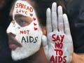 World AIDS Vaccine Day: एड्स होने से पहले क्या संकेत मिलते हैं और मरीज कितने दिन जिंदा रह सकता है ? - Hindi News | World AIDS Vaccine Day 2020 Date, History, Significance, signs and symptoms of hiv in men and women in hindi | Latest health News at Lokmatnews.in