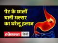 Home Remedies । पेट के छालों यानी अल्सर का घरेलू इलाज, दर्द में तुरंत मिलेगा आराम । ulcer treatment - Hindi News | Home Remedies Home remedies for stomach ulcers, you will get instant relief in pain. ulcer treatment | Latest health Videos at Lokmatnews.in