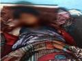 बुआ को नाबालिग भतीजियों ने काट दिया टांगी से, जानिए पूरा मामला - Hindi News | The aunt was cut off by the minor nieces from the tangi, know the whole matter | Latest crime News at Lokmatnews.in