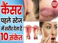 कैंसर होने से पहले शरीर देता है ये 10 चेतावनी, युवा लड़के-लड़कियों में कॉमन है छठा संकेत - Hindi News | Early sign and symptoms of first stage Cancer, causes, risk factors, treatment, prevention of all type cancer in Hindi | Latest health Videos at Lokmatnews.in
