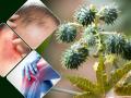 Health Tips: कई बीमारियों का इलाज है अरंडी का तेल, बालों का झड़ना, जोड़ों में दर्द और कब्ज में है लाभदायक - Hindi News | Castor Oil Benefits for hair castor oil use for joint pain skin treatment constipation home remedies | Latest health Photos at Lokmatnews.in
