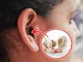 Ear Pain tips : कान के भयंकर दर्द से कुछ ही मिनटों में आराम देते हैं ये 7 घरेलू उपाय - Hindi News | Ear Pain tips : 7 Effective Remedies for Earache | Latest health News at Lokmatnews.in