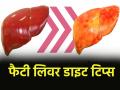 बारिश का मौसम आते ही खूब खा रहे हैं तली चीजें, तो हो जाइए सावधान; लिवर को होगा नुकसान - Hindi News | Fatty Liver Diet Tips in hindi | Latest health News at Lokmatnews.in