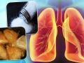 Healthy Lungs Tips: फेफड़ों को रखें स्वस्थ और फिट, बिलकुल न खाएं और पिएं ये चीजें - Hindi News | Foods good for lungs and breathing healthy lungs tips home remedies in hindi | Latest health Photos at Lokmatnews.in