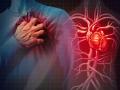 World Heart Day 2023: आज है विश्व हृदय दिवस, जानिए इस का उद्देश्य और महत्व - Hindi News | World Heart Day 2023 Today is Heart Day Know its purpose and importance | Latest health News at Lokmatnews.in