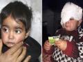 क्या लौट सकेगी पैलेट गन की शिकार नन्हीं हिबा की आंखों की रोशनी! - Hindi News | | Latest india News at Lokmatnews.in