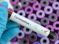 Coronavirus: कोरोना वायरस से बचने के लिए कारगर हैं ये 5 उपाय, इनको अपनाकर COVID-19 से होगा बचाव - Hindi News | how to prevent coronavirus covid 19 disease prevention clean hands sanitizer use masks | Latest health Photos at Lokmatnews.in