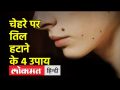 तिल से हैं परेशान? आजमाऐं ये नुस्खें, नहीं होगा कोई साइड इफेक्ट - Hindi News | Troubled by moles? Try these tips, there will be no side effect | Latest health Videos at Lokmatnews.in