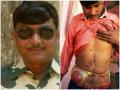 नक्सली हमले में मौत के मुंह से बाहर आया था जवान, 4 साल से पॉलीथीन में आंत रख कर भटकने को मजबूर - Hindi News | Madhya pradesh CRPF jawan is compelled to live with keeping intestine in polythene | Latest india News at Lokmatnews.in