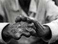 World Leprosy Day 2019: त्वचा, आंख, नाक ही नहीं लिंग, योनि और किडनी को भी खराब कर सकता है कुष्ठ रोग, इस 6 महीने के इलाज से मिलेगी मुक्ति - Hindi News | world leprosy day 2019 : causes, sign, symptoms, treatment, prevention, home remedies and myths about leprosy | Latest health News at Lokmatnews.in