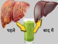 लिवर साफ करने के उपाय, लिवर में जमा गंदगी निकलेगी बाहर, अपनाएं ये 6 आसान टिप्स - Hindi News | How to Detox Liver Naturally 6 Tips to Detox and Cleanse Liver Naturally Home Remedies | Latest health Photos at Lokmatnews.in